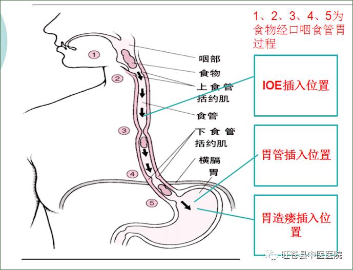 喉咙吞剑攻略：滑稽探秘游戏界的神秘热潮