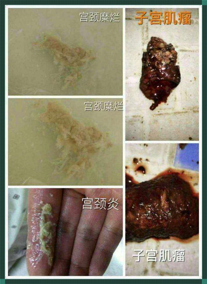 《月月，我这是帮你排阴毒的小说啊！》